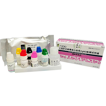 ���͸��ײ������Ŀ��壨IgM������Լ��� ��ø�����߷���